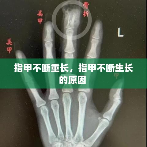 指甲不斷重長，指甲不斷生長的原因 