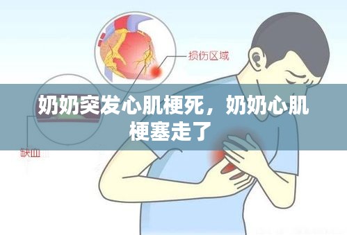 奶奶突發(fā)心肌梗死，奶奶心肌梗塞走了 