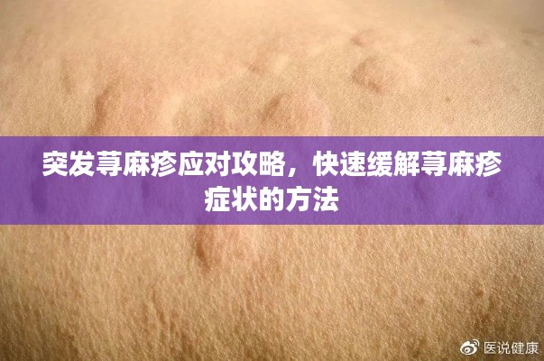 突發(fā)蕁麻疹應(yīng)對(duì)攻略，快速緩解蕁麻疹癥狀的方法