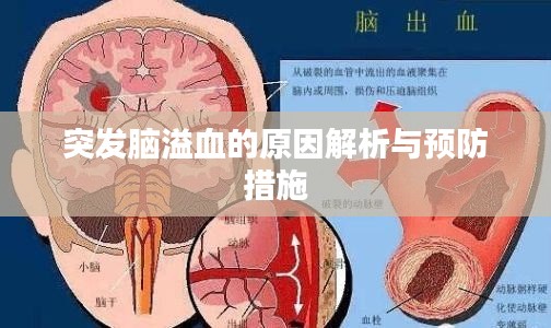 突發(fā)腦溢血的原因解析與預防措施