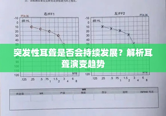 突發(fā)性耳聾是否會(huì)持續(xù)發(fā)展？解析耳聾演變趨勢(shì)