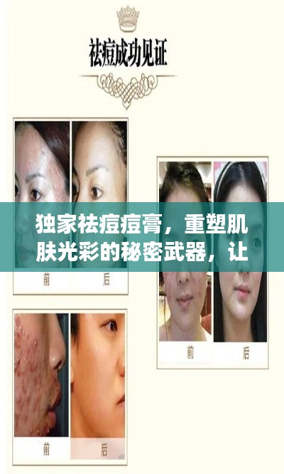 獨家祛痘痘膏，重塑肌膚光彩的秘密武器，讓你擁有無瑕美肌！
